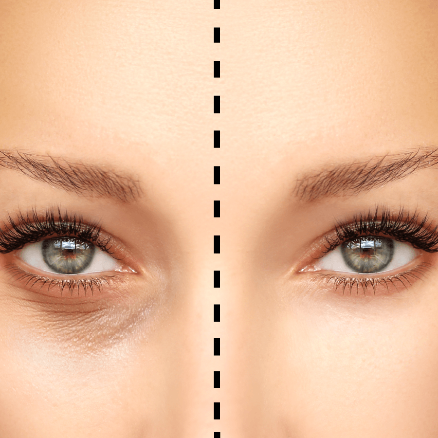 areoles-corrections-maquillage-permanent-bosen